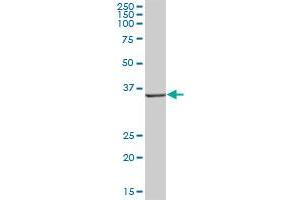 AKR1D1 MaxPab polyclonal antibody.