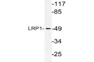 Western blot (WB) analysis of LRP1 antibody in extracts from HepG2 cells. (LRP1 anticorps)