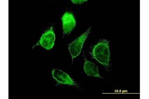 Immunofluorescence of purified MaxPab antibody to ECHS1 on HeLa cell. (ECHS1 anticorps  (AA 1-290))