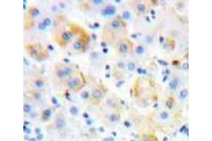 IHC-P analysis of Liver tissue, with DAB staining. (P-Selectin anticorps  (AA 58-259))