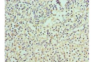 Immunohistochemistry of paraffin-embedded human spleen tissue using ABIN7166400 at dilution of 1:100
