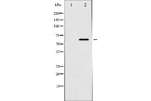 Western blot analysis of p62 Dok expression in K562 whole cell lysates,The lane on the left is treated with the antigen-specific peptide.