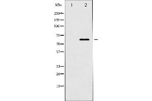 Western blot analysis of p62 Dok expression in K562 whole cell lysates,The lane on the left is treated with the antigen-specific peptide. (DOK1 anticorps  (Internal Region))