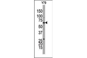 Western blot analysis of anti-GUCY1B3 Pab((ABIN392806 and ABIN2842242)) in Y79 cell line lysate.
