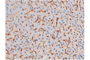 ABIN6267485 at 1/200 staining Mouse liver tissue sections by IHC-P.