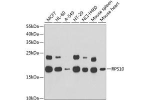 Western blot analysis of extracts of various cell lines, using RPS10 antibody (ABIN6132945, ABIN6147192, ABIN6147194 and ABIN6221686) at 1:1000 dilution. (RPS10 anticorps  (AA 1-165))