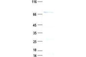 Validation with Western Blot