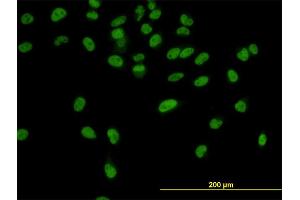 Immunofluorescence of monoclonal antibody to CPSF3 on HeLa cell.