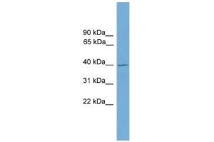 WB Suggested Anti-FBXO31 Antibody Titration: 0. (FBXO31 anticorps  (Middle Region))