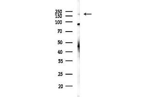anti-ATP-Binding Cassette, Sub-Family A (ABC1), Member 6 (ABCA6) (C-Term) antibody