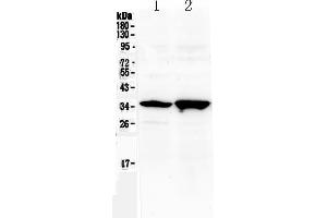 Western blot analysis of Six3 using anti-Six3 antibody . (SIX3 anticorps  (N-Term))