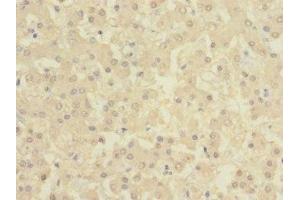 Immunohistochemistry of paraffin-embedded human liver tissue using ABIN7145876 at dilution of 1:100 (BTN1A1 anticorps  (AA 27-210))
