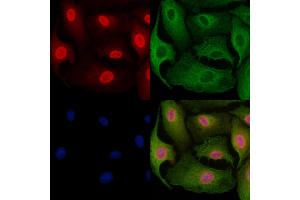 ABIN6261287 and ABIN6279346 staining  cells by IF/ICC.