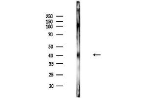 anti-Pyruvate Dehydrogenase Kinase 1 (PDK1) (pTyr243) antibody