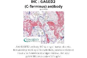 Image no. 1 for anti-X Antigen Family, Member 1B (XAGE1B) (C-Term) antibody (ABIN1734558) (XAGE1B/GAGED2 anticorps  (C-Term))