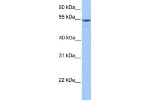 WB Suggested Anti-KIAA1958 Antibody Titration: 0. (KIAA1958 anticorps  (C-Term))