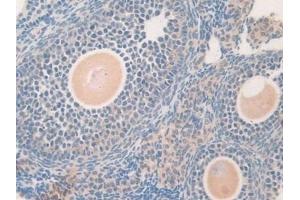 Detection of GDF5 in Mouse Ovary Tissue using Polyclonal Antibody to Growth Differentiation Factor 5 (GDF5)