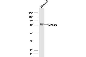 Rat stomach lysates probed with MARS2 Polyclonal Antibody, Unconjugated  at 1:300 dilution and 4˚C overnight incubation.
