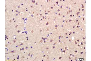 Formalin-fixed and paraffin embedded rat brain labeled with Rabbit Anti AKR1A1 Polyclonal Antibody, Unconjugated (ABIN872733) at 1:200 followed by conjugation to the secondary antibody and DAB staining (AKR1A1 anticorps  (AA 53-130))
