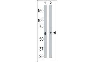 The anti-CERK Pab (ABIN391126 and ABIN2841252) is used in Western blot to detect CERK in mouse heart tissue lysate (Lane 1) and  cell lysate (Lane 2).