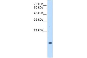 PPIA antibody used at 2. (PPIA anticorps)