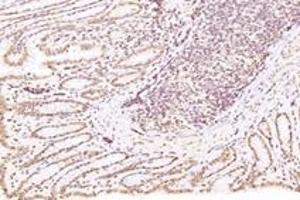 Immunohistochemistry analysis of paraffin-embedded rat colon using,RanBP16 (ABIN7073901) at dilution of 1: 2000