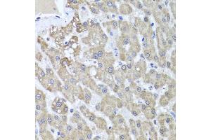 Immunohistochemistry of paraffin-embedded human liver injury using ALKBH4 antibody (ABIN5974944) at dilution of 1/100 (40x lens). (ALKBH4 anticorps)