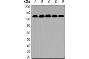 Western blot analysis of OGT expression in K562 (A), A549 (B), Hela (C), mouse spleen (D), mouse brain (E) whole cell lysates. (OGT anticorps)