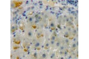 Used in DAB staining on fromalin fixed paraffin-embedded Liver tissue