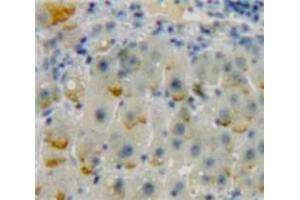 Used in DAB staining on fromalin fixed paraffin-embedded Liver tissue (ADCY9 anticorps  (AA 1029-1282))