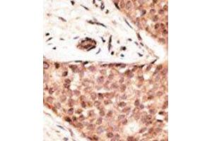 Image no. 2 for anti-Caudal Type Homeobox 2 (CDX2) (N-Term) antibody (ABIN358610) (CDX2 anticorps  (N-Term))