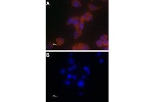 Expression of TRPV6 in PC-3 cells - Immunocytochemical staining of paraformaldehyde-fixed PC-3 cells with Anti-TRPV6 Antibody (ABIN7043857, ABIN7043998 and ABIN7043999), (1:100) followed by goat anti-rabbit-AlexaFluor-555 secondary antibody (A) or with a mixture of Anti-TRPV6 Antibody and TRPV6 peptide antigen (1:20) (B).