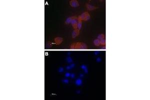 Expression of TRPV6 in PC-3 cells - Immunocytochemical staining of paraformaldehyde-fixed PC-3 cells with Anti-TRPV6 Antibody (ABIN7043857, ABIN7043998 and ABIN7043999), (1:100) followed by goat anti-rabbit-AlexaFluor-555 secondary antibody (A) or with a mixture of Anti-TRPV6 Antibody and TRPV6 peptide antigen (1:20) (B). (TRPV6 anticorps  (C-Term, Intracellular))