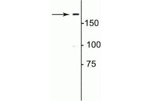 Western blot of rat lung lysate showing specific immunolabeling of the ~180 kDa collagen 1. (COL1A1 anticorps)