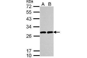 WB Image Sample (30 ug of whole cell lysate) A: A549 B: H1299 12% SDS PAGE antibody diluted at 1:5000 (UCHL1 anticorps  (C-Term))