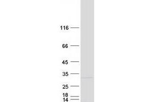 Validation with Western Blot