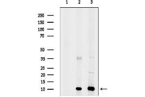 anti-Sec61 beta Subunit (SEC61B) (N-Term) antibody