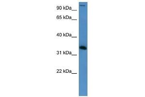 HADH antibody used at 0. (HADH anticorps  (Middle Region))