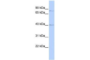 WB Suggested Anti-ZNF214 Antibody Titration:  0. (ZNF214 anticorps  (N-Term))