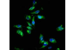 Immunofluorescence staining of Hela cells with ABIN7152021 at 1:133, counter-stained with DAPI. (EPOR anticorps  (AA 320-506))