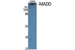 Western Blot (WB) analysis of specific cells using MADD Polyclonal Antibody. (MADD anticorps  (Internal Region))