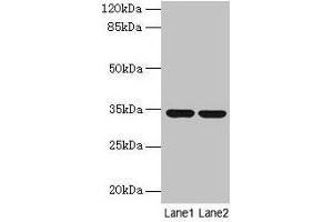 Western blot All lanes: MRPL19 antibody at 2 μg/mL Lane 1: MCF-7 whole cell lysate Lane 2: Mouse liver tissue Secondary Goat polyclonal to rabbit IgG at 1/10000 dilution Predicted band size: 34 kDa Observed band size: 34 kDa (MRPL19 anticorps  (AA 1-292))