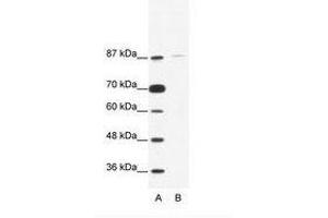 Image no. 1 for anti-TATA Box Binding Protein (TBP)-Associated Factor, RNA Polymerase I, C, 110kDa (TAF1C) (C-Term) antibody (ABIN203252) (TAF1C anticorps  (C-Term))