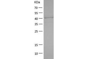 Western Blotting (WB) image for serpin Peptidase Inhibitor, Clade A (Alpha-1 Antiproteinase, Antitrypsin), Member 5 (SERPINA5) (AA 20-406) protein (His-IF2DI Tag) (ABIN7125048)