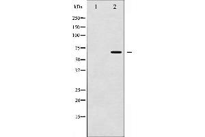 Western blot analysis of Chk2 phosphorylation expression in Jurkat whole cell lysates,The lane on the left is treated with the antigen-specific peptide. (CHEK2 anticorps  (pThr387))
