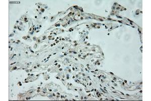 Image no. 2 for anti-L1 Cell Adhesion Molecule (L1CAM) antibody (ABIN1499089) (L1CAM anticorps)