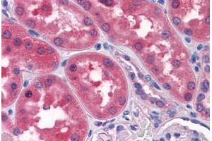 Human Kidney: Formalin-Fixed, Paraffin-Embedded (FFPE)