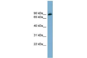 WB Suggested Anti-APBB1IP Antibody Titration: 0.