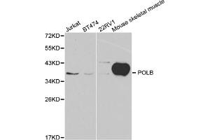 Western blot analysis of extracts of various cell lines, using POLB antibody (ABIN5970839) at 1/1000 dilution. (POLB anticorps)