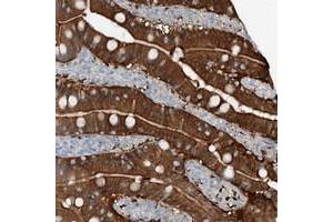 Immunohistochemical staining of human duodenum with ANKRD34A polyclonal antibody  shows strong cytoplasmic and membrane positivity in glandular cells. (ANKRD34A anticorps)
